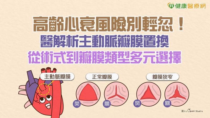 高齡心衰風險別輕忽!醫解析主動脈瓣膜置換 從術式到瓣膜類型多元選擇