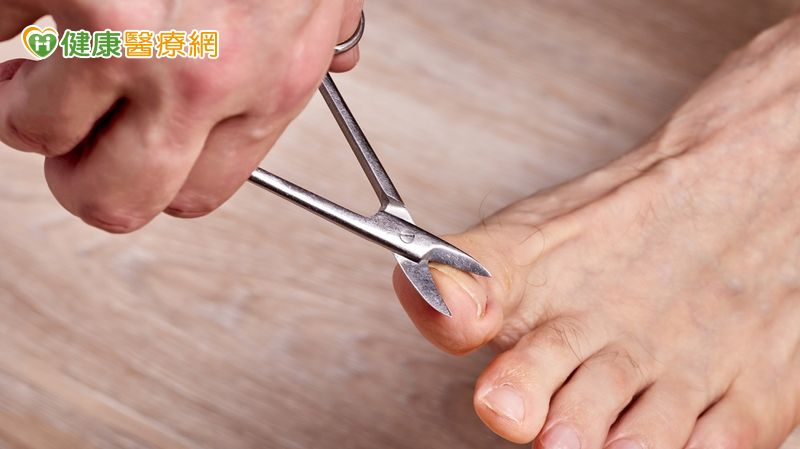 八旬翁厚甲致嵌甲多年 醫院「專業足部護理」解決疼痛之苦