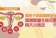 罹患子宮肌瘤難受孕?需視肌瘤生長位置與大小而定