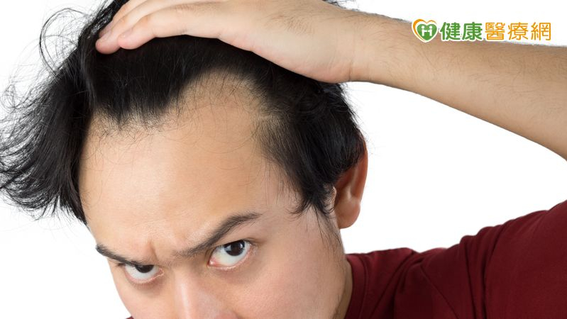 35 歲男髮際線後退「M型禿」!中醫「1治療」改善掉髮、新髮冒出