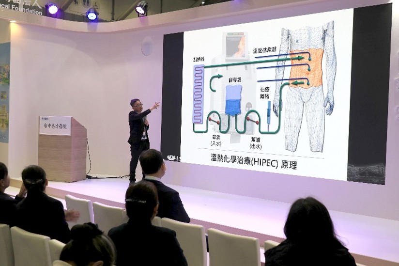 身心有溫度抗癌 高階熱治療強化腹膜腫瘤療效 messageImage 1765114697644