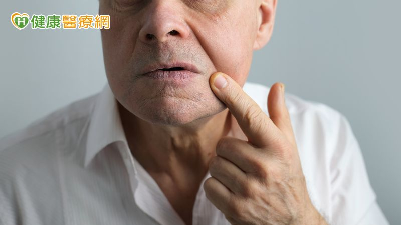 別輕忽不痛不癢的痣!七旬翁拖兩年竟變皮膚癌