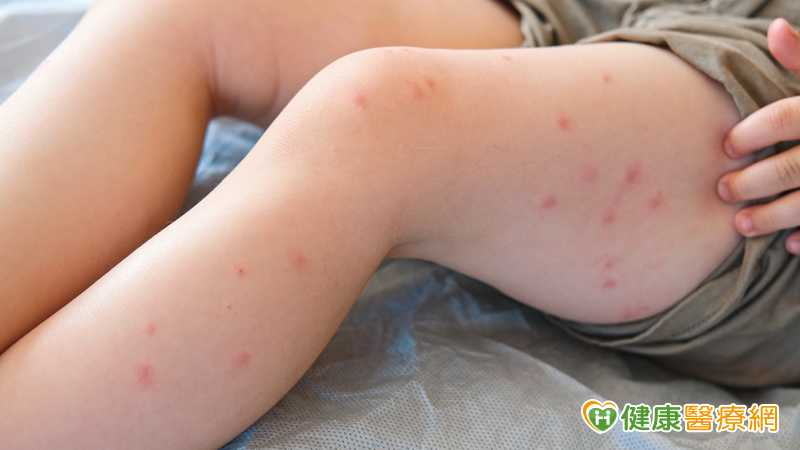 女童疑遭「蘋果病」B19病毒奪命 疾管署:若併發心肌炎致死率達3成