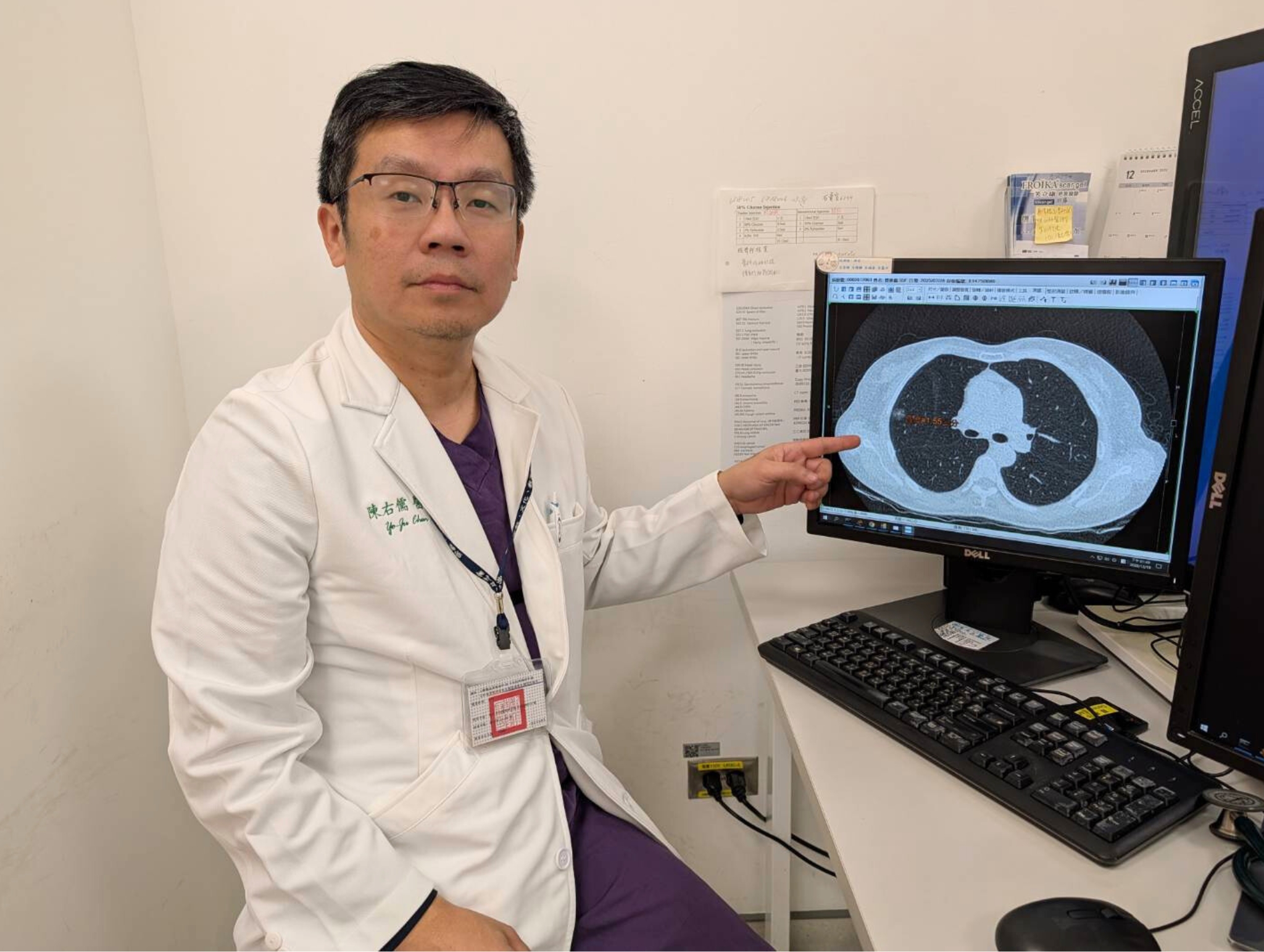 不抽菸也會得肺癌!恩主公醫院籲及早接受LDCT篩檢 把握黃金治療期 bhs5g65g