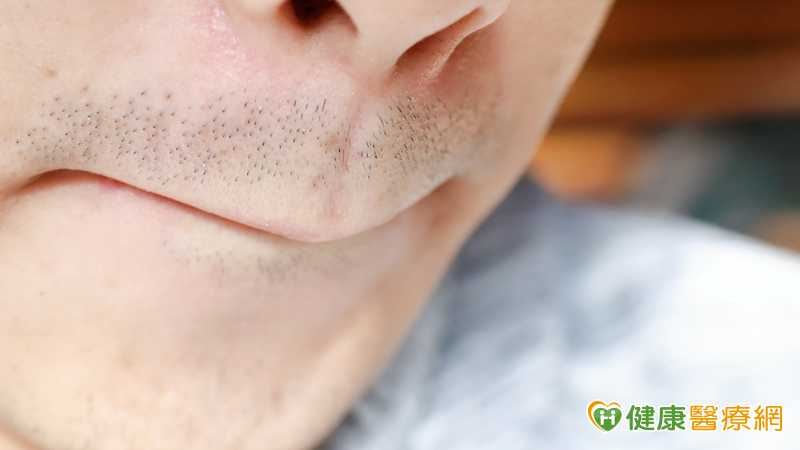 男鬍子變濃竟和「天天DIY」有關? 醫搖頭:2關鍵決定