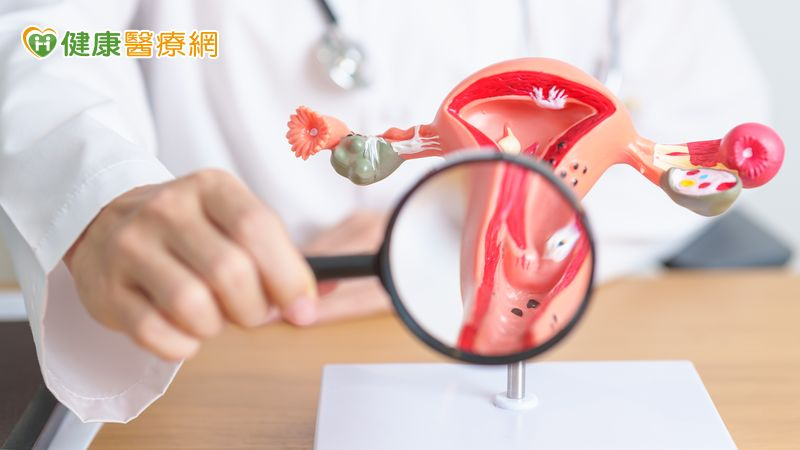 因備孕發現子宮頸癌前病變!醫籲:早期切除才能安心備孕 因備孕發現子宮頸癌前病變!醫籲:早期切除才能安心備孕