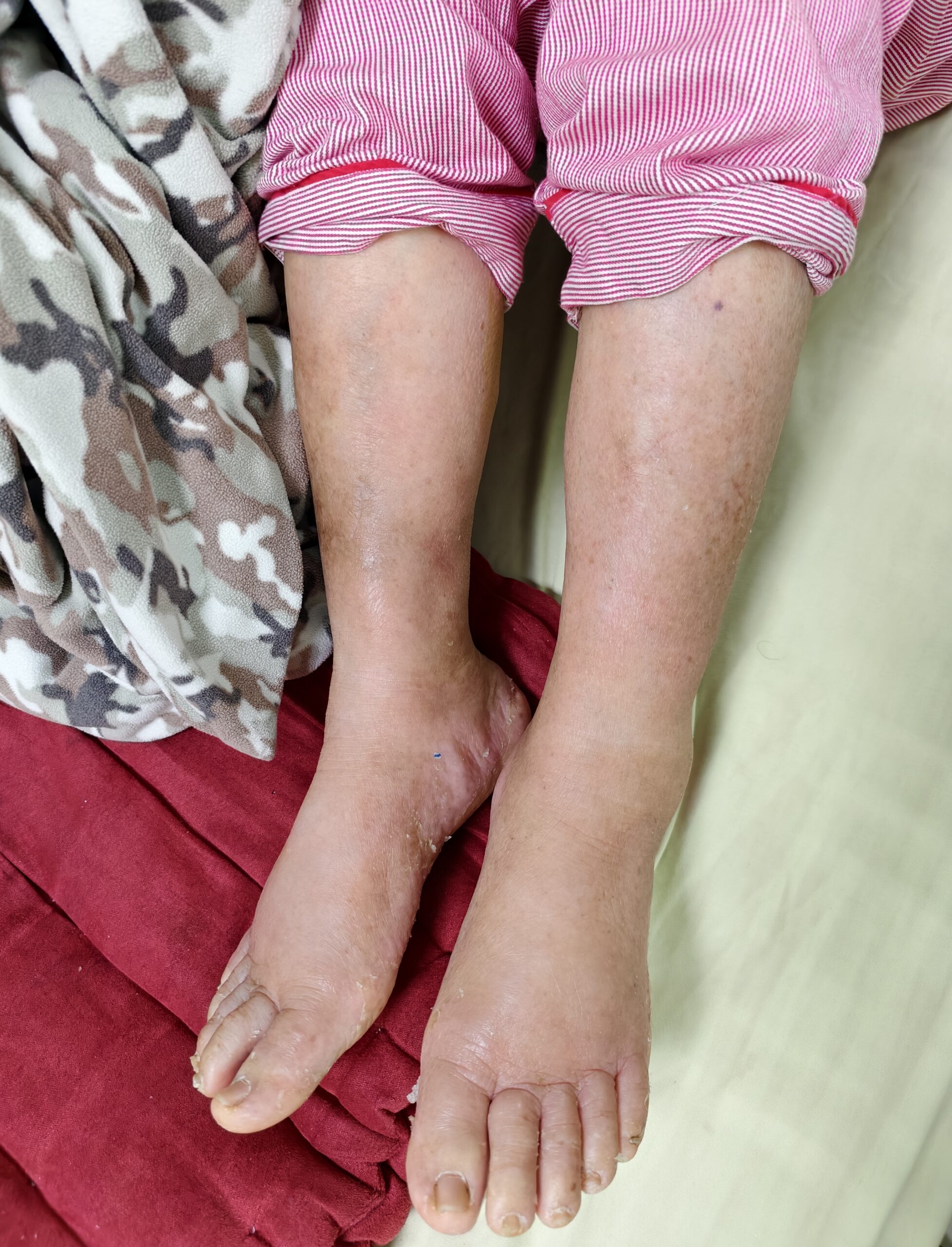 2治療一天後 0 scaled