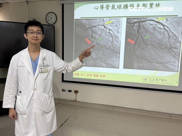 34歲男打遊戲胸痛、冒冷汗 以為工作太累「竟是心肌梗塞」 34歲男打遊戲胸痛、冒冷汗 以為工作太累「竟是心肌梗塞」