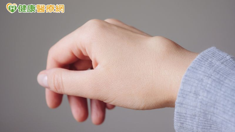 腱鞘囊腫治好又復發!他手腕長出「半顆乒乓球」醫揭治療新選擇
