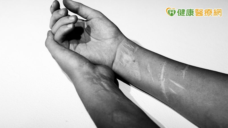 孩子不開門、不上學只是叛逆?揭青少年憂鬱症「4大求救警訊」