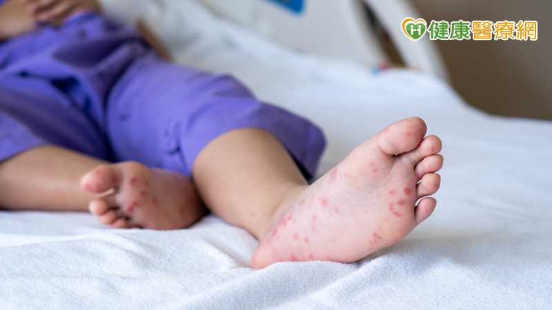 腸病毒疫情升溫!女童併發猛爆性心肌炎亡 30歲男重症住加護未脫險 腸病毒疫情升溫!女童併發猛爆性心肌炎亡 30歲男重症住加護未脫險