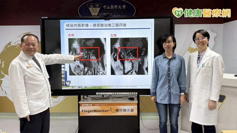 總不自覺咬牙也釀頭痛、肩頸痛?醫:當心「顳顎關節障礙症候群」上身 總不自覺咬牙也釀頭痛、肩頸痛?醫:當心「顳顎關節障礙症候群」上身