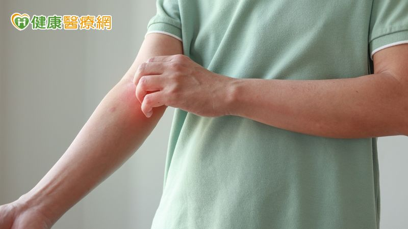 過敏族注意!醫揭「異病同治」新觀念 治療方式大改變 過敏族注意!醫揭「異病同治」新觀念 治療方式大改變