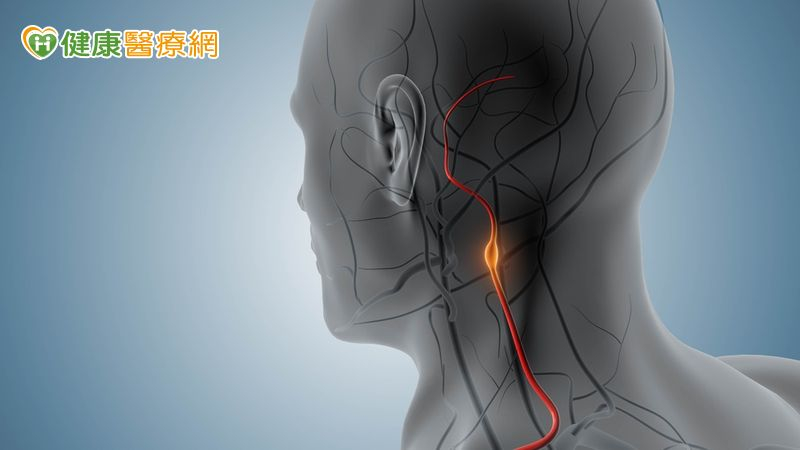 常頭暈又單側手腳發麻!醫警示:頸動脈狹窄恐釀中風風險 常頭暈又單側手腳發麻!醫警示:頸動脈狹窄恐釀中風風險