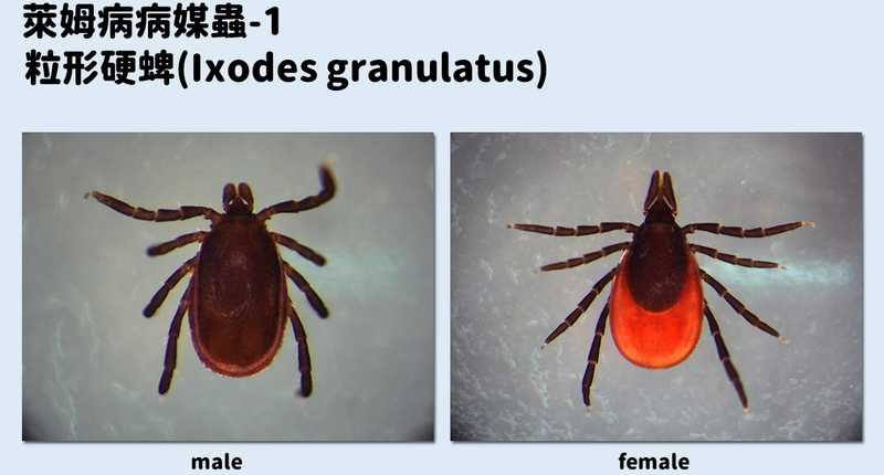 不治療恐延續數年!6旬婦紅斑和血尿上身 疾管署揭萊姆病預防措施 不治療恐延續數年!6旬婦紅斑和血尿上身 疾管署揭萊姆病預防措施