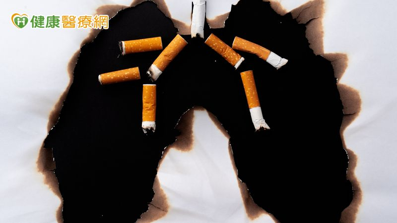 肺癌第一期五年存活逾九成 低劑量電腦斷層篩檢揪苗頭 肺癌第一期五年存活逾九成 低劑量電腦斷層篩檢揪苗頭