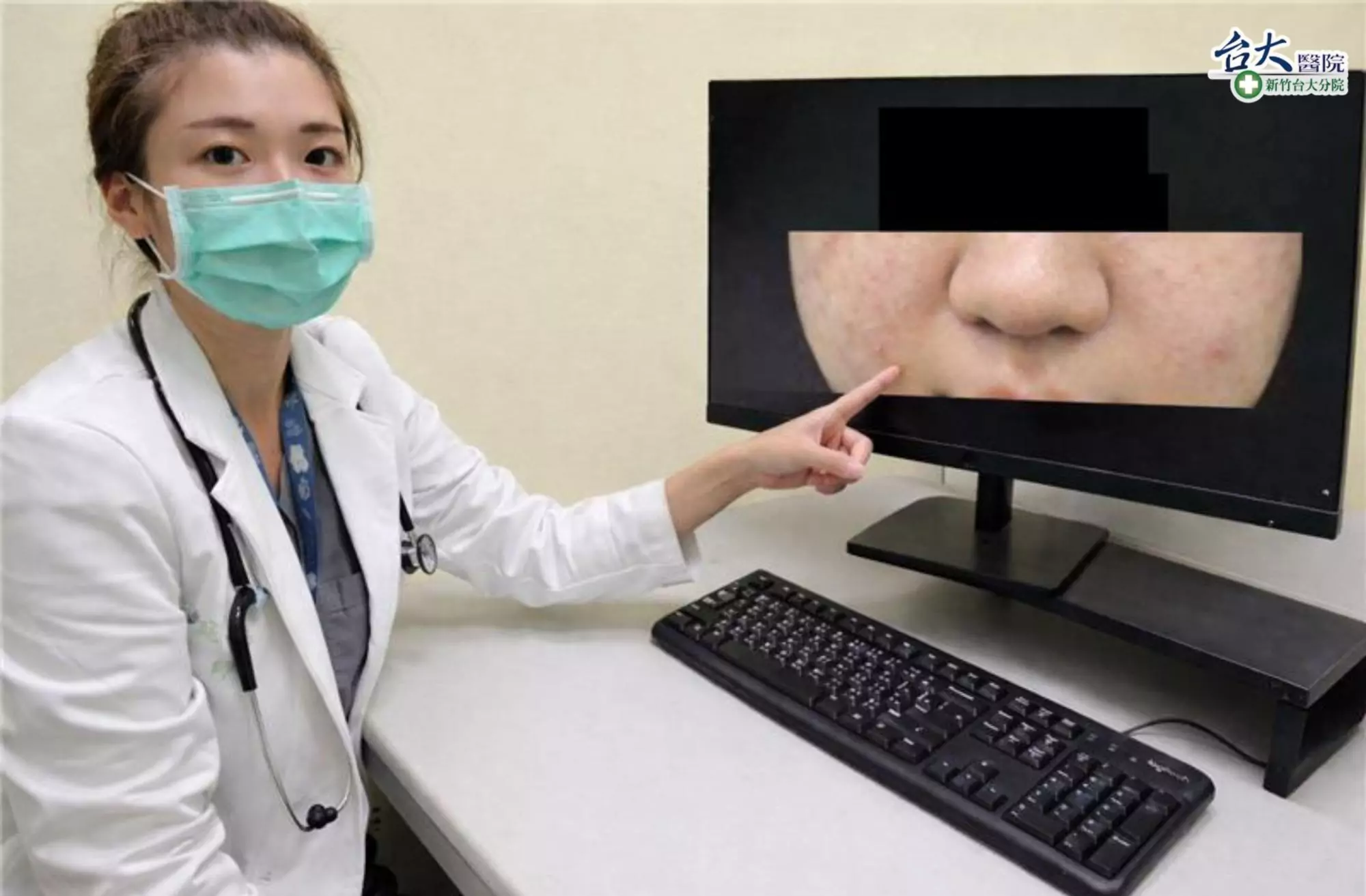 10歲童臉腫全身起紅疹 醫:延誤就醫恐過敏性休克 17784645495238