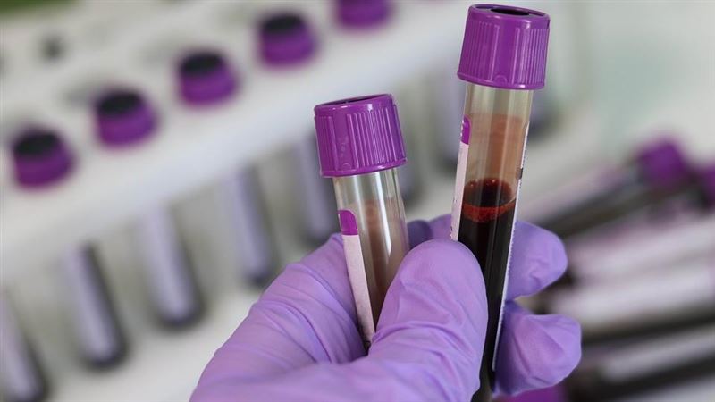 抽血1數值過高 小心痛風、慢性腎衰竭 抽血1數值過高 小心痛風、慢性腎衰竭