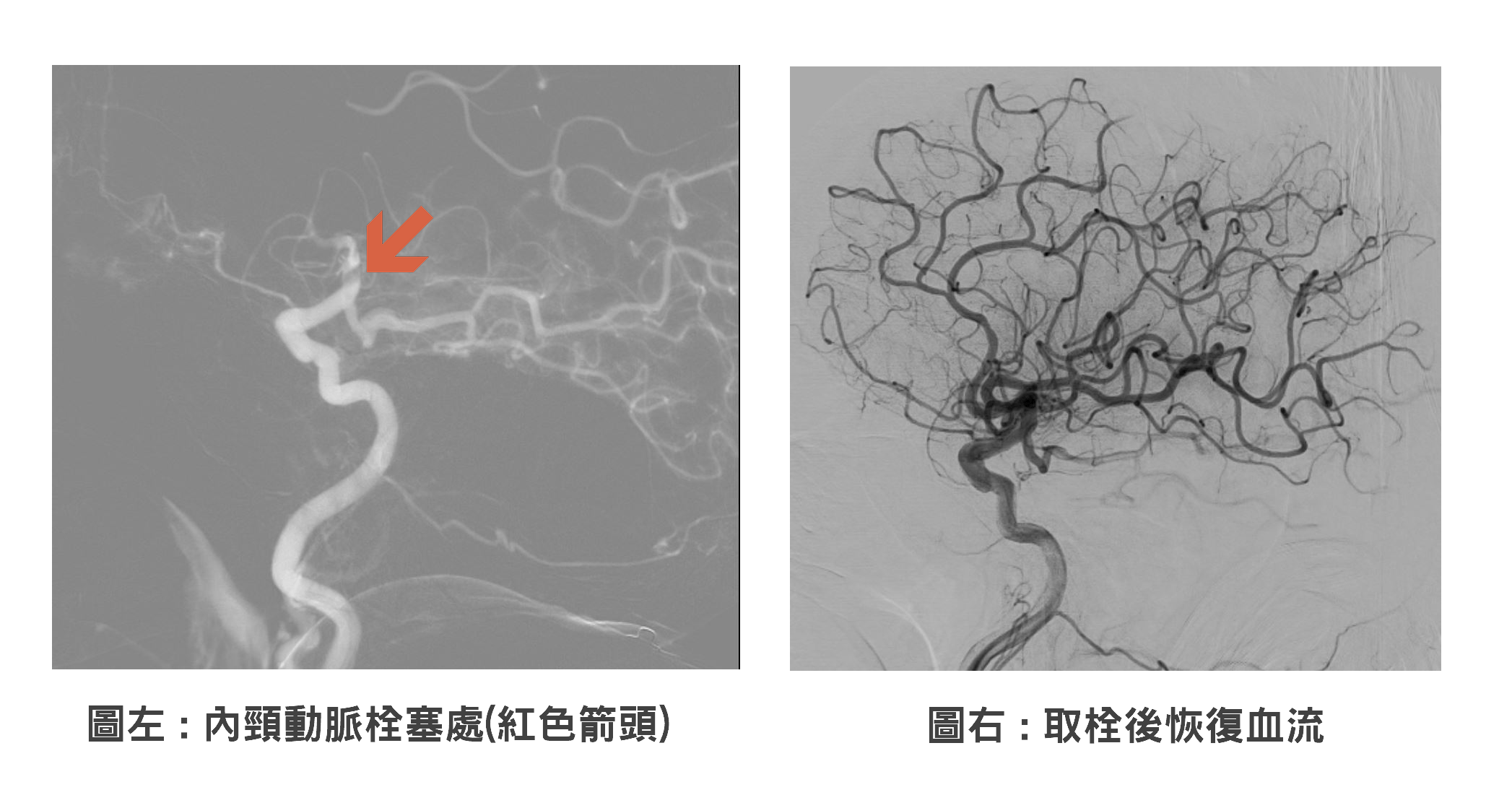 新版桃園e指通7月上線 增至1300項服務辦理還能抽旅遊券 取栓前後對比照 0