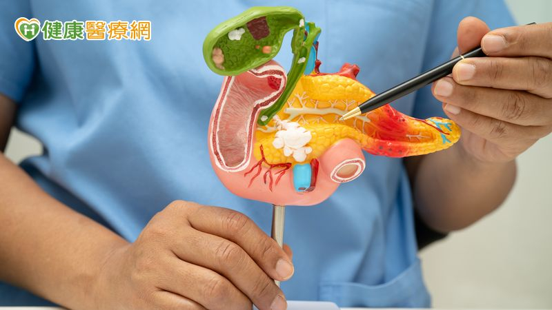 胰臟癌治療迎進展!新藥臨床試驗顯示患者存活期延長 研究結果獲臨床關注 胰臟癌治療迎進展!新藥臨床試驗顯示患者存活期延長 研究結果獲臨床關注